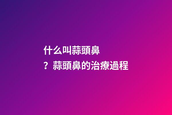 什么叫蒜頭鼻？蒜頭鼻的治療過程